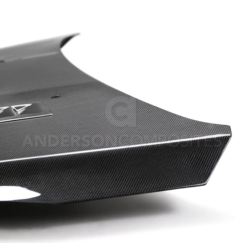 Anderson Composites 2016-2017 Ford Focus ST/RS Carbon Fiber RS Hood-thumbmail-5