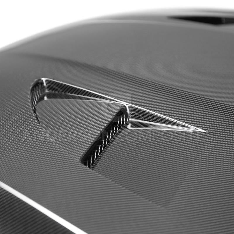 Anderson Composites 2015+ Ford Focus RS Type-SA Carbon Fiber Hood-thumbmail-7
